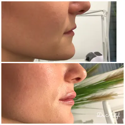 Medycyna Estetyczna - MOTYL CLINIC